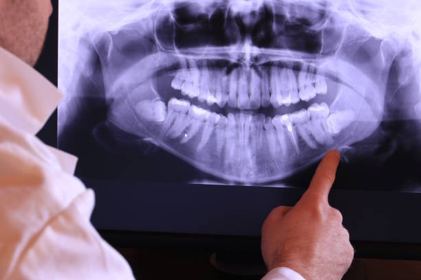 Best Broken or Cracked Tooth Emergency Dentist in Lockney, TX