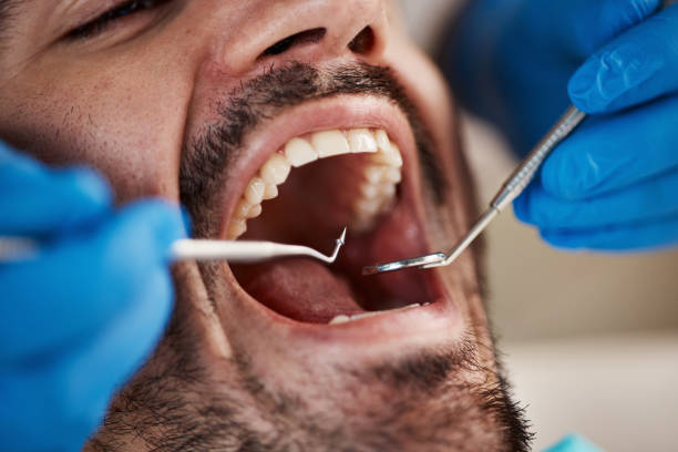 Best Emergency Dentist for Lost Fillings or Crowns in Lockney, TX